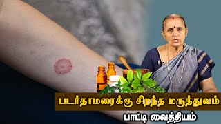 படர்தாமரைக்கு  சிறந்த மருத்துவம் | பாட்டி வைத்தியம் | GEM TV