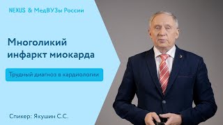 Многоликий инфаркт миокарда