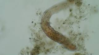 Specimen 3 Freshwater worms