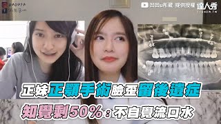 【正妹正顎手術臉歪留後遺症 知覺剩50%：不自覺流口水】｜@ououyu