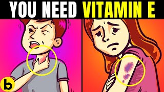 Do You Really Need Vitamin E Supplements?