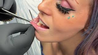 Getting  Side Lip Piercing: Watch the Process