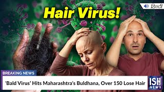 'Bald Virus’ Hits Maharashtra’s Buldhana, Over 150 Lose Hair | ISH News