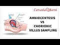 Amniocentesis vs Chorionic Villus Sampling