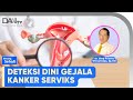 Deteksi Dini Kanker Serviks | Bincang Sehati