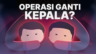 Mimpi Gila Sains untuk Operasi Ganti Kepala