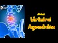 Vertebral Augmentation | Improve Spine Strength  - Dr. Kodlady Surendra Shetty | Doctors' Circle