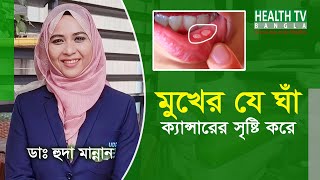 মুখের ঘাঁ বা ক্যান্সার এর কারণ, লক্ষণ ও চিকিৎসা | Mukher gha | Oral Cancer | Mukher Cancer | Bangla