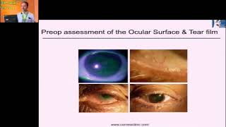 AIOC2018 - GP120 - Capsules - Cornea Society of India (CSI) - Dr.Rajesh Fogla