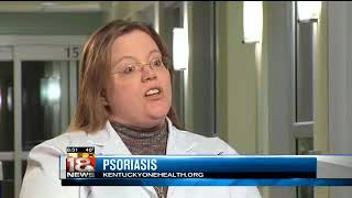 Healthbreak: Dr. Pennington on Psoriasis