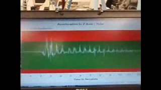 CoasterDynamix Accelerometer Graphing
