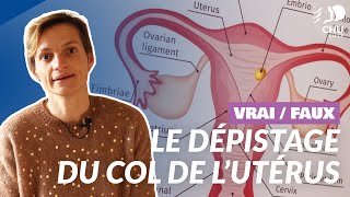 VRAI ou FAUX - Le dépistage du col de l'utérus