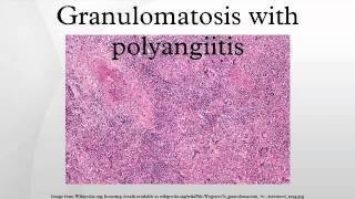 Granulomatosis with polyangiitis