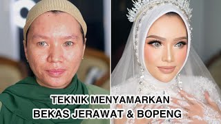 TUTORIAL TEKNIK MAKEUP MENYAMARKAN BEKAS JERAWAT PADA WAJAH PENGANTIN