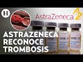 ¿Qué es y cuáles son los síntomas de la trombosis, enfermedad ligada a la vacuna de AstraZeneca?