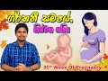 Pregnancy 30th Week | Sinhala Medical Review | අම්මයි බබයි