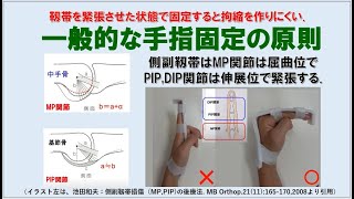 14分10秒）アルフェンスシーネによる指固定   ①解説編