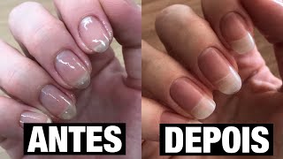 A MELHOR VITAMINA PARA GRÁVIDAS E LACTANTES | UNHAS E CABELOS