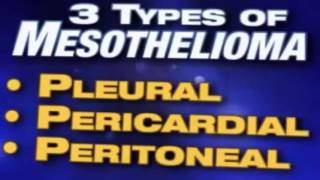 Mesothelioma Attorney Explains Process |/Attorney