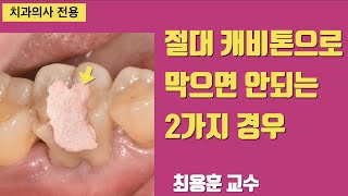 통증 생기는 이유와 해결책 #1회신경치료 #최용훈교수 #판교최용훈치과