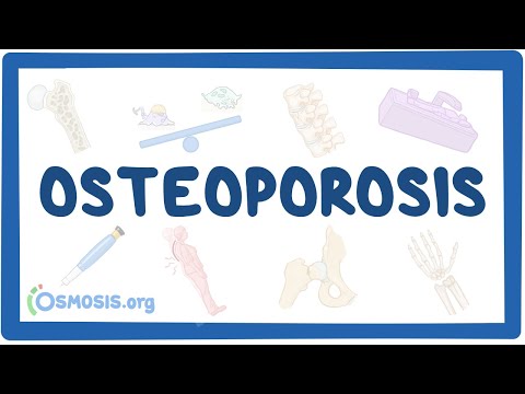 What diseases affect bones?