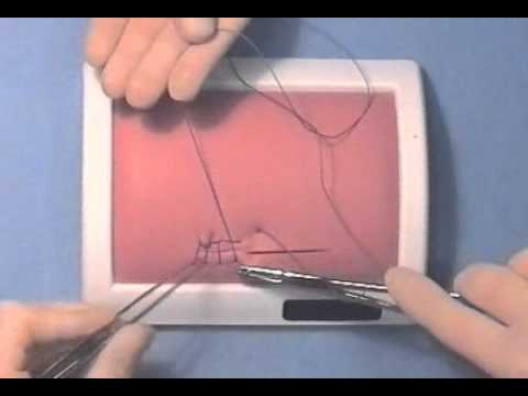 Continuous Locked Suture Youtube