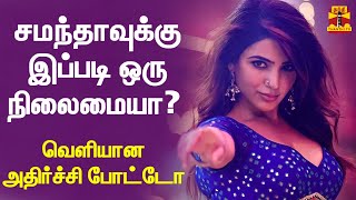 சமந்தாவுக்கு என்ன ஆச்சு? - வெளியான அதிர்ச்சி போட்டோ | Samantha | Samantha Photo