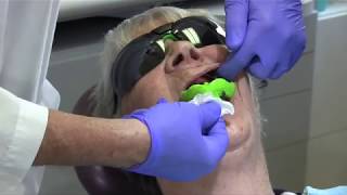 Complete Denture Impressions Two Mirror Technique
