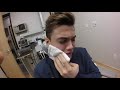 grayson gets his wisdom teeth removed dolan twins