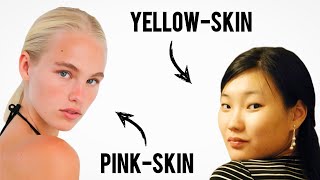 White Skin Explained ( Not What you Think ).