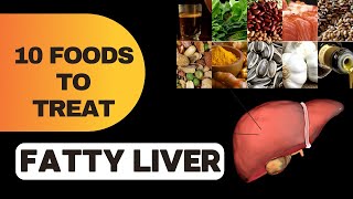 Top 10 Foods To Treat Fatty Liver Disease