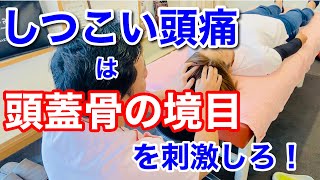 しつこい頭痛に頭蓋骨のつなぎ目を刺激しよう【宮崎県宮崎市ほりうち鍼灸整骨院】