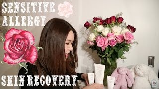 【针对敏感肌+脸部皮肤过敏+激素脸恢复💁最好用的平价护肤品】Sensitive, Allergy Skin Recovery