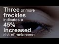 Melanoma is in the eye of the beholder