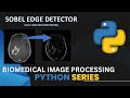 Sobel Edge detector |Python Code implementation | Image Processing |Computer vision