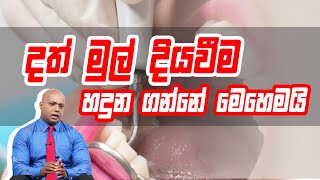 දත් මුල් දියවීම හදුන ගන්නේ මෙහෙමයි | Piyum Vila | 31 - 07 -2020 | Siyatha TV