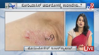 Nimma Doctor | Treatment For Psoriasis  | Homeocare International (04-06-2022)