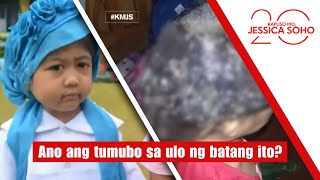 Ano ang tumubo sa ulo ng batang ito? | Kapuso Mo, Jessica Soho