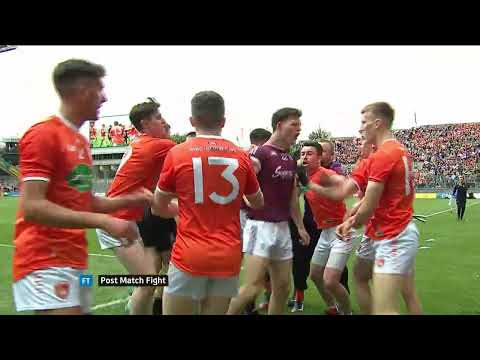How far is Armagh from Dublin?