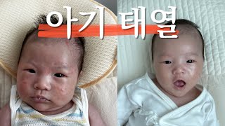 [👶🏻 육아 vlog] 신생아 아기 태열, 로션, 제품 추천, 수면 환경, 쿨리베어 옆잠베개, 머미쿨쿨, 수딩젤, 란시노크림