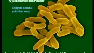 2.24. Mycobacteria, Corynebacteria and Legionella - Medical Microbiology