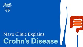 Mayo Clinic Explains Crohn’s Disease