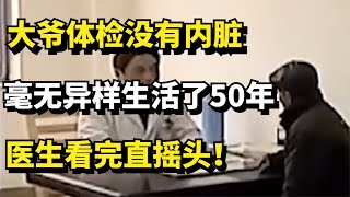 江苏大爷体检没有内脏，毫无异样生活了50年，医生看完直摇头！