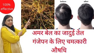 अमर बेल का जादुई तेल || गंजेपन के लिए चमत्कारी औषधि || Digitalsaasumaa