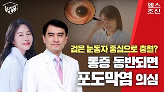 포도막염, 자가면역질환 동반되면 실명 위험! 조기 진단 및 빠른 치료 중요해