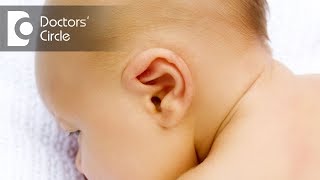 What is Glue Ear? - Dr. Shalina Ray