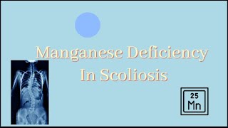 Manganese Deficiency In Scoliosis|JUNIOR BREAKTHROUGH CHALLENGE 2023|Alisha Yin