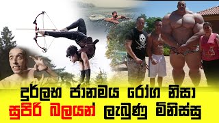 මිනිසුන්ට සුපිරි බලයන් ලබා දෙන දුර්ලභ ලෙඩ රෝග 5ක්  Rare Diseases That Turn People Into Superheroes