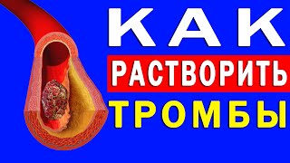 Как Растворить Тромбы в Сосудах и Избежать Инсульта | Полезные Советы для Жизни