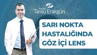 Sarı nokta hastalığında teleskopik lensler - Prof. Dr. Tansu Erakgün